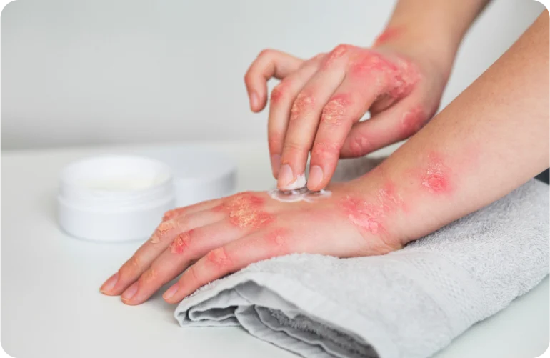 Houston Product Liability Lawyer